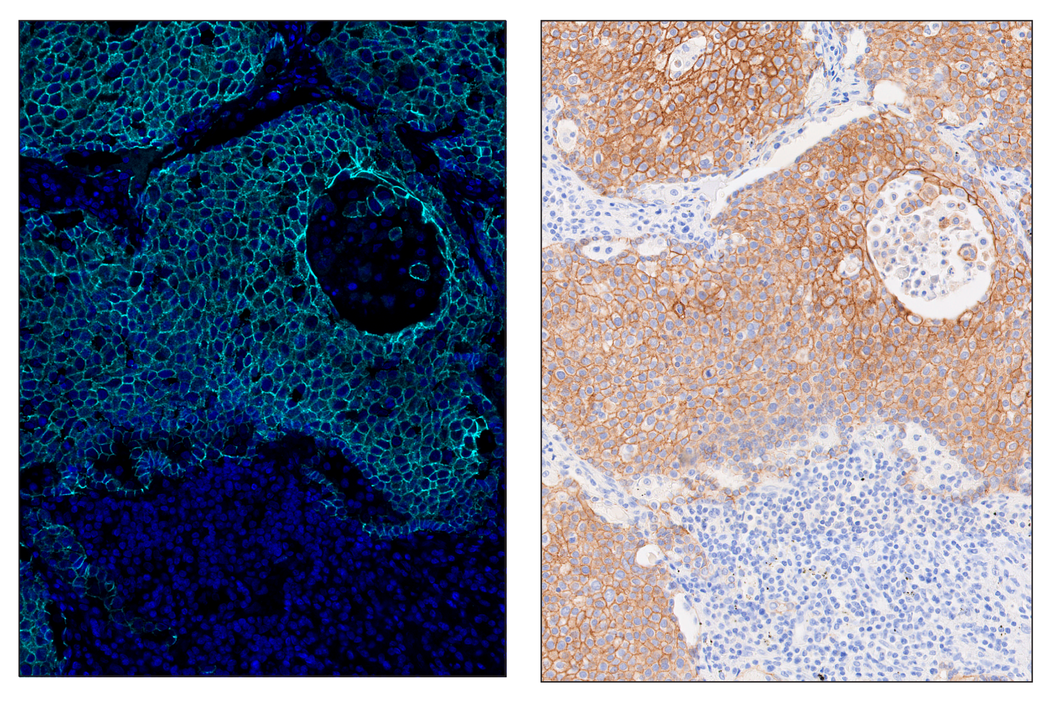 Immunohistochemistry Image 6: E-Cadherin (24E10) & CO-0103-647 SignalStar™ Oligo-Antibody Pair