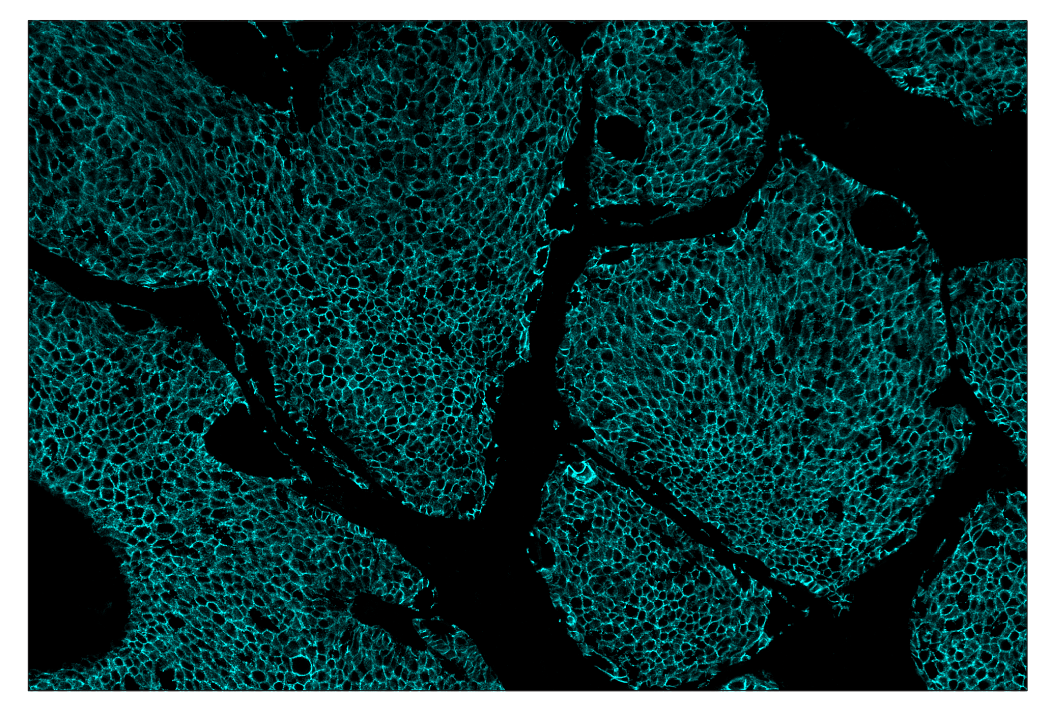 Immunohistochemistry Image 5: E-Cadherin (24E10) & CO-0103-647 SignalStar™ Oligo-Antibody Pair