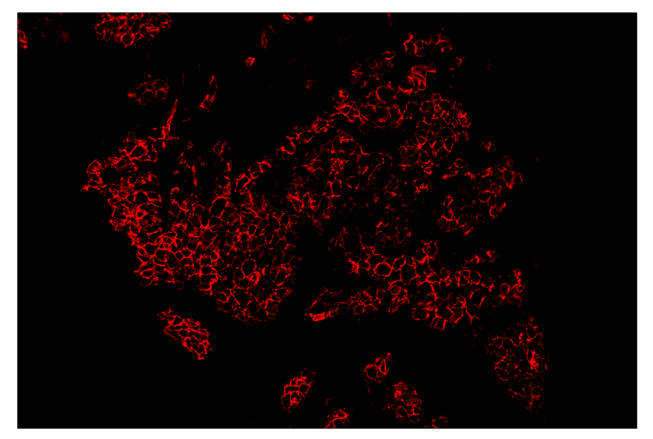 Immunohistochemistry Image 4: E-Cadherin (24E10) & CO-0103-647 SignalStar™ Oligo-Antibody Pair