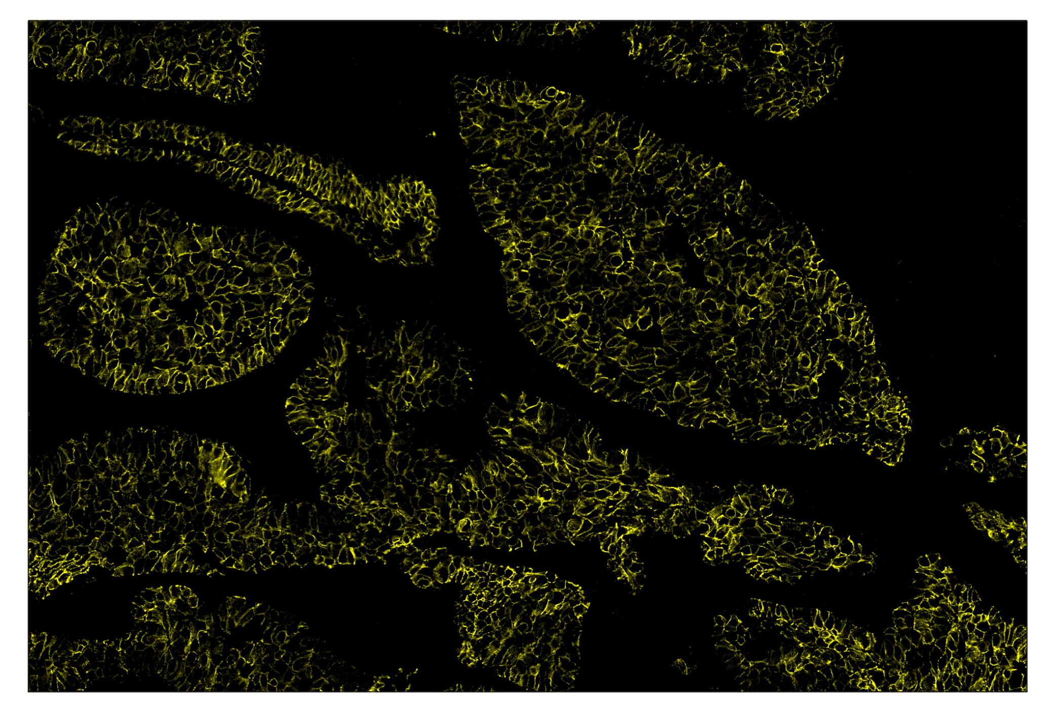 Immunohistochemistry Image 3: E-Cadherin (24E10) & CO-0103-647 SignalStar™ Oligo-Antibody Pair