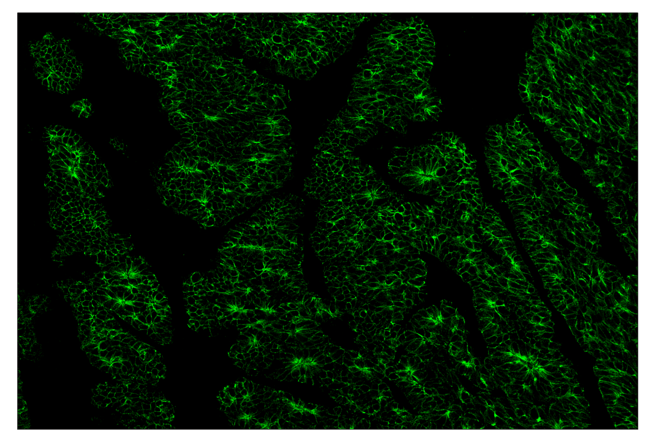 Immunohistochemistry Image 2: E-Cadherin (24E10) & CO-0103-647 SignalStar™ Oligo-Antibody Pair