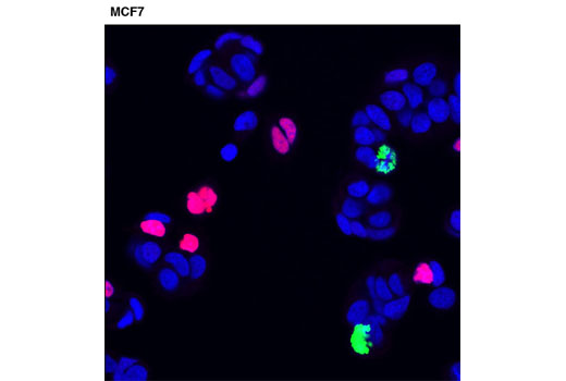 Immunofluorescence Image 1: p21 Waf1/Cip1 (12D1) Rabbit mAb (Alexa Fluor® 555 Conjugate)