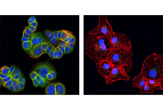 Immunofluorescence Image 1: Met (D1C2) XP® Rabbit mAb (Alexa Fluor® 488 Conjugate)