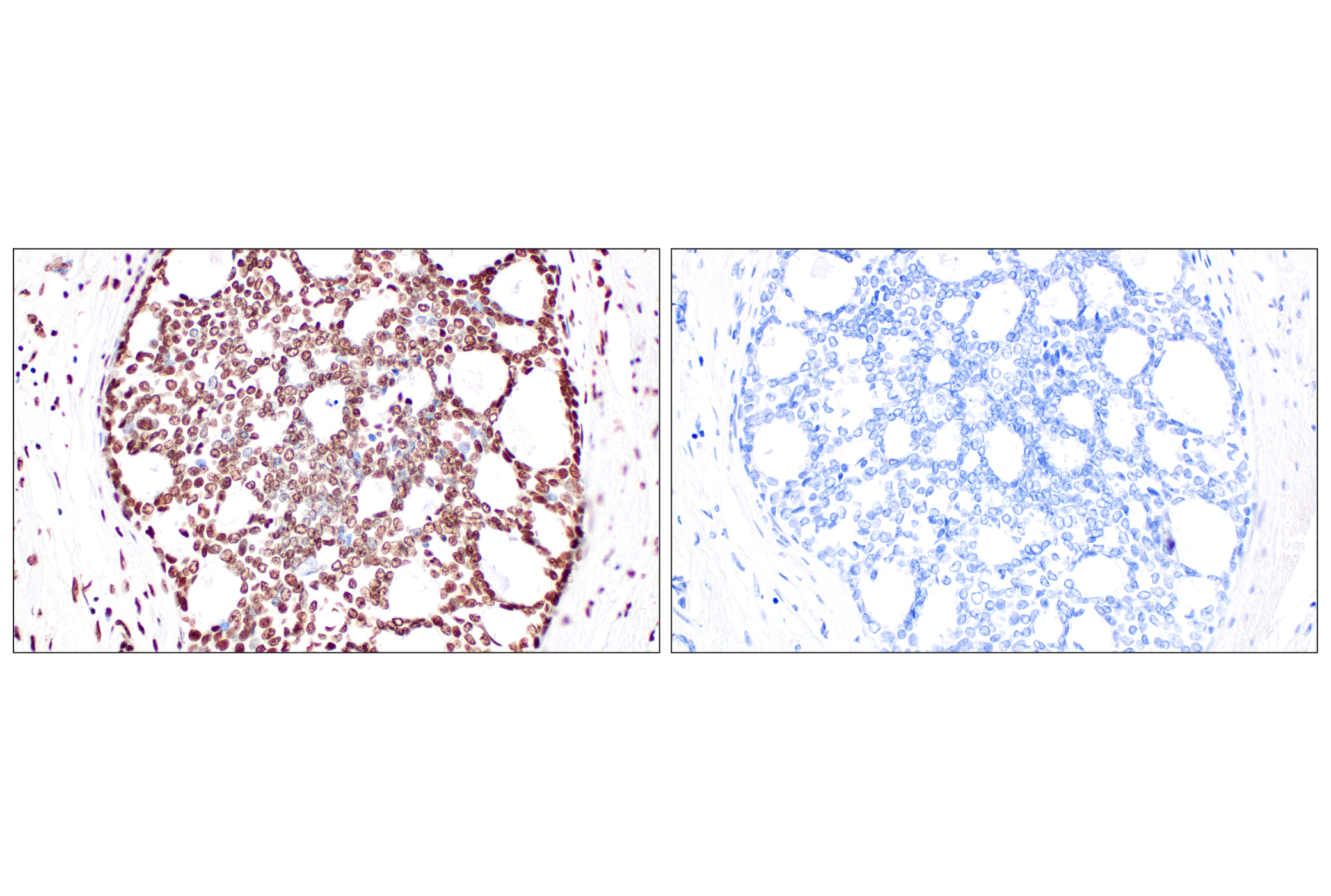 Immunohistochemistry Image 10: NPM1 (E7W4P) Rabbit mAb (BSA and Azide Free)