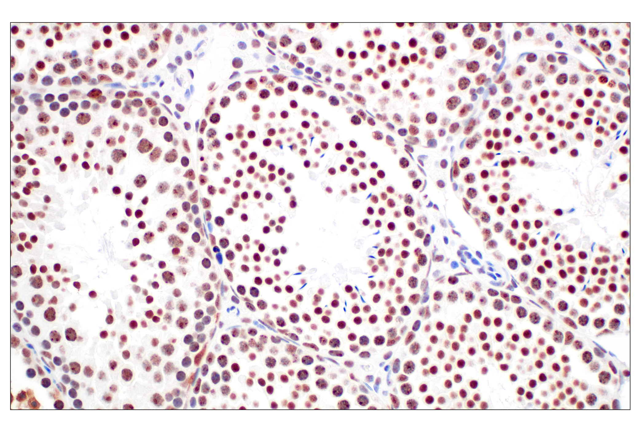 Immunohistochemistry Image 9: NPM1 (E7W4P) Rabbit mAb (BSA and Azide Free)