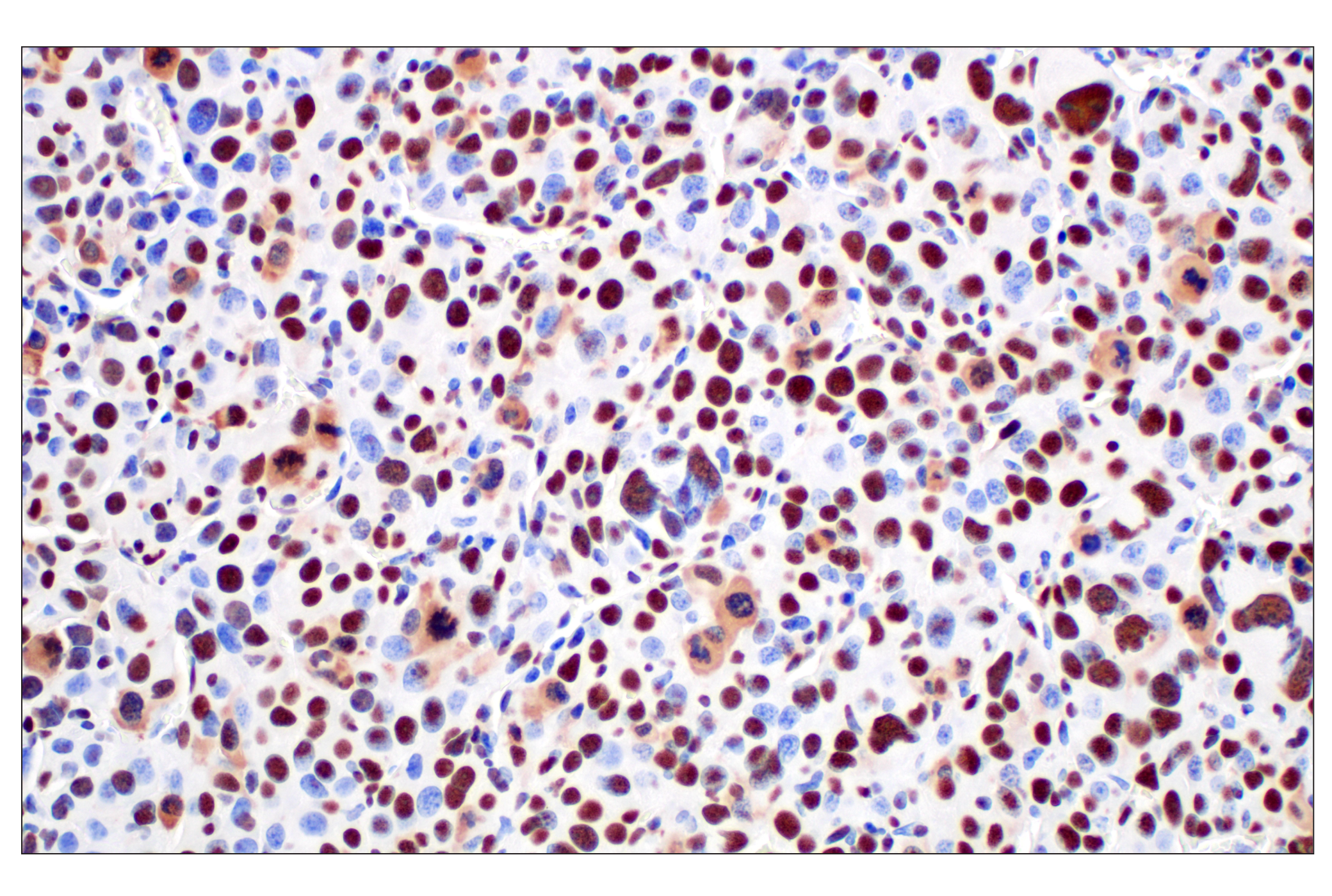 Immunohistochemistry Image 7: NPM1 (E7W4P) Rabbit mAb (BSA and Azide Free)