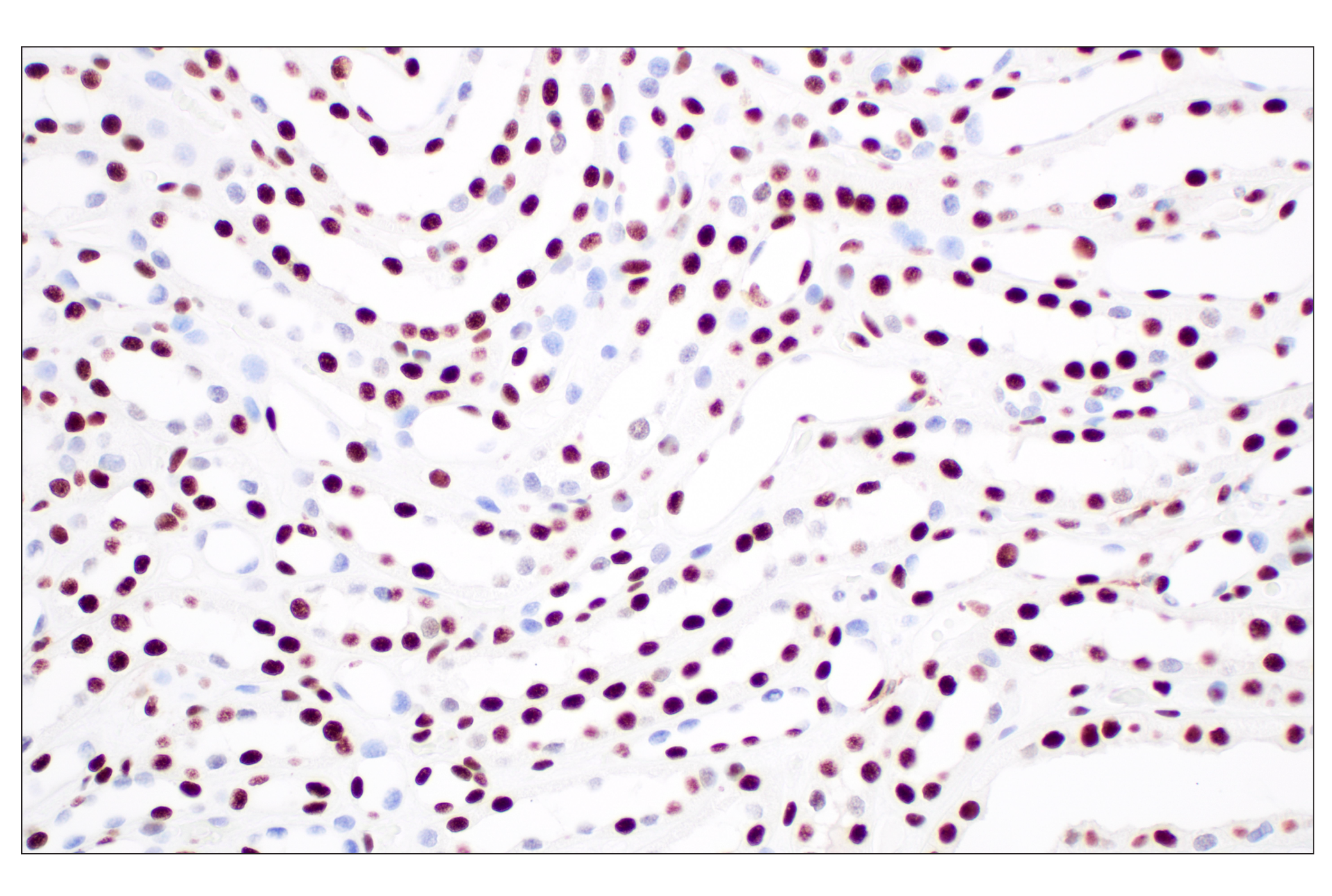 Immunohistochemistry Image 5: NPM1 (E7W4P) Rabbit mAb (BSA and Azide Free)