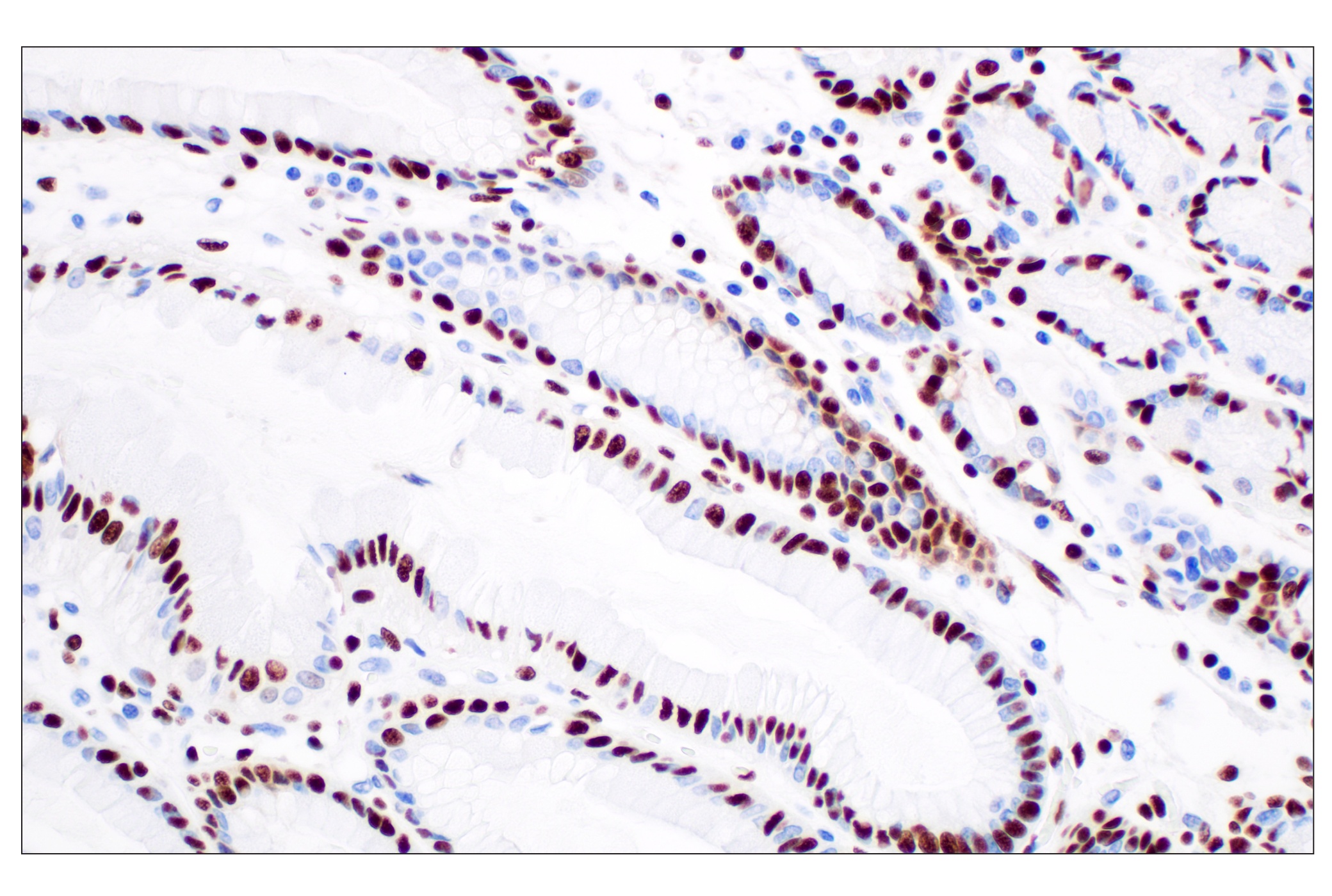 Immunohistochemistry Image 3: NPM1 (E7W4P) Rabbit mAb (BSA and Azide Free)