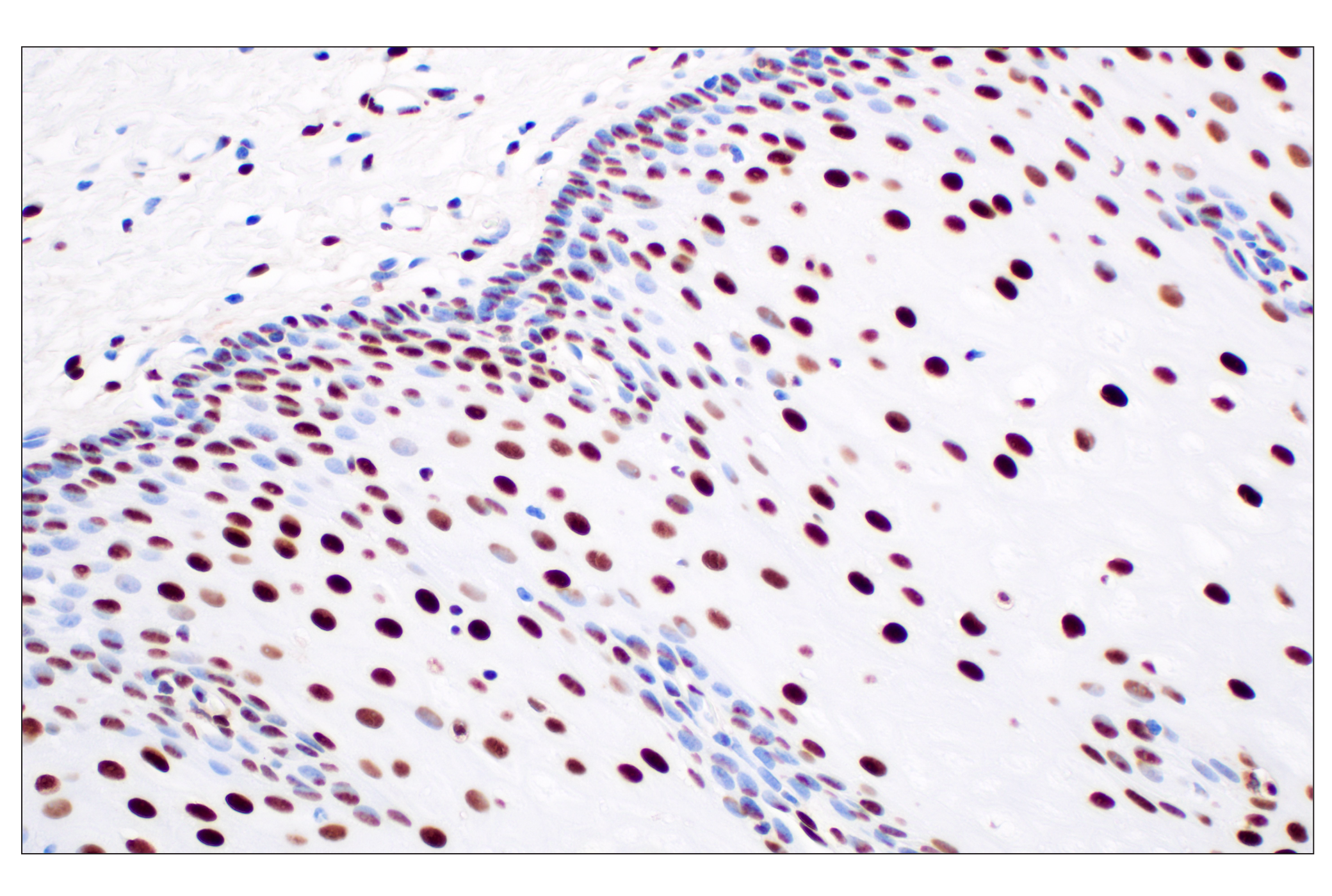 Immunohistochemistry Image 4: NPM1 (E7W4P) Rabbit mAb (BSA and Azide Free)