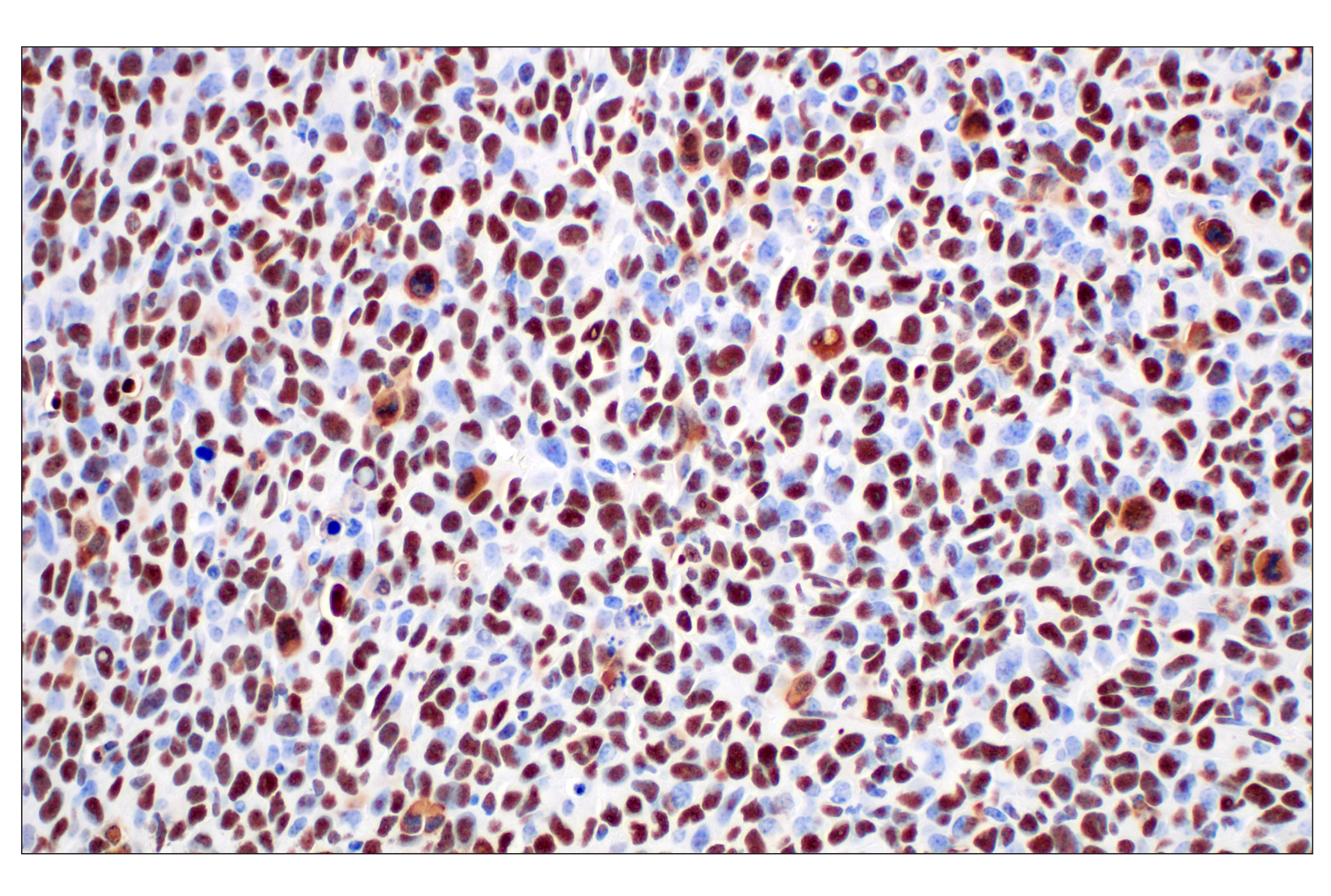 Immunohistochemistry Image 8: NPM1 (E7W4P) Rabbit mAb (BSA and Azide Free)