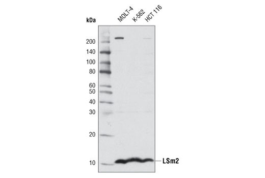 Western Blotting Image 1: LSm2 Antibody