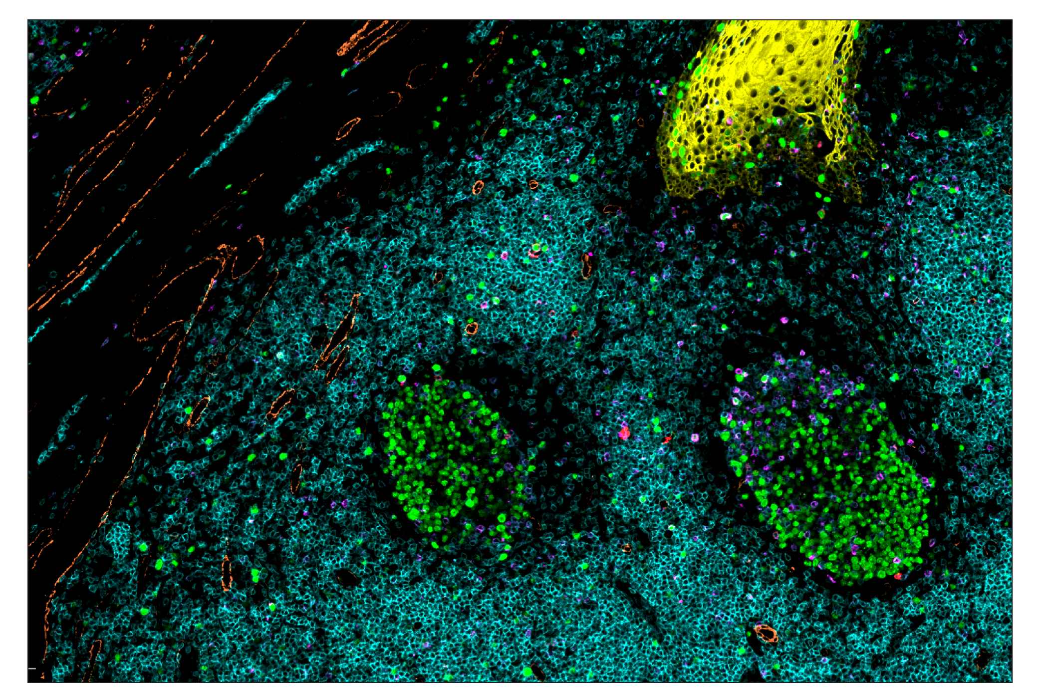 Immunohistochemistry Image 6: CTLA-4 (E2V1Z) & CO-0078-488 SignalStar™ Oligo-Antibody Pair