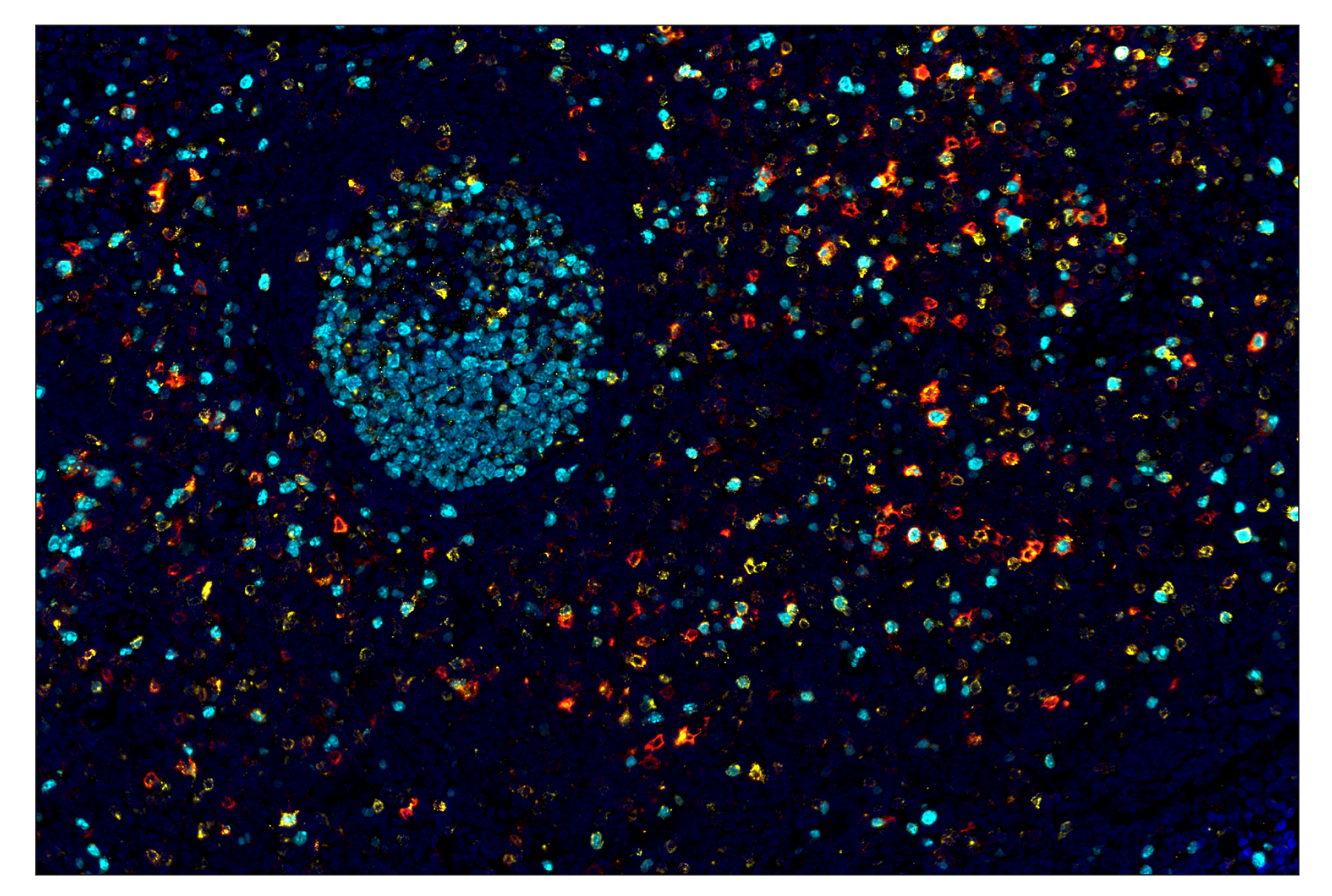 Immunohistochemistry Image 7: CTLA-4 (E2V1Z) & CO-0078-594 SignalStar™ Oligo-Antibody Pair