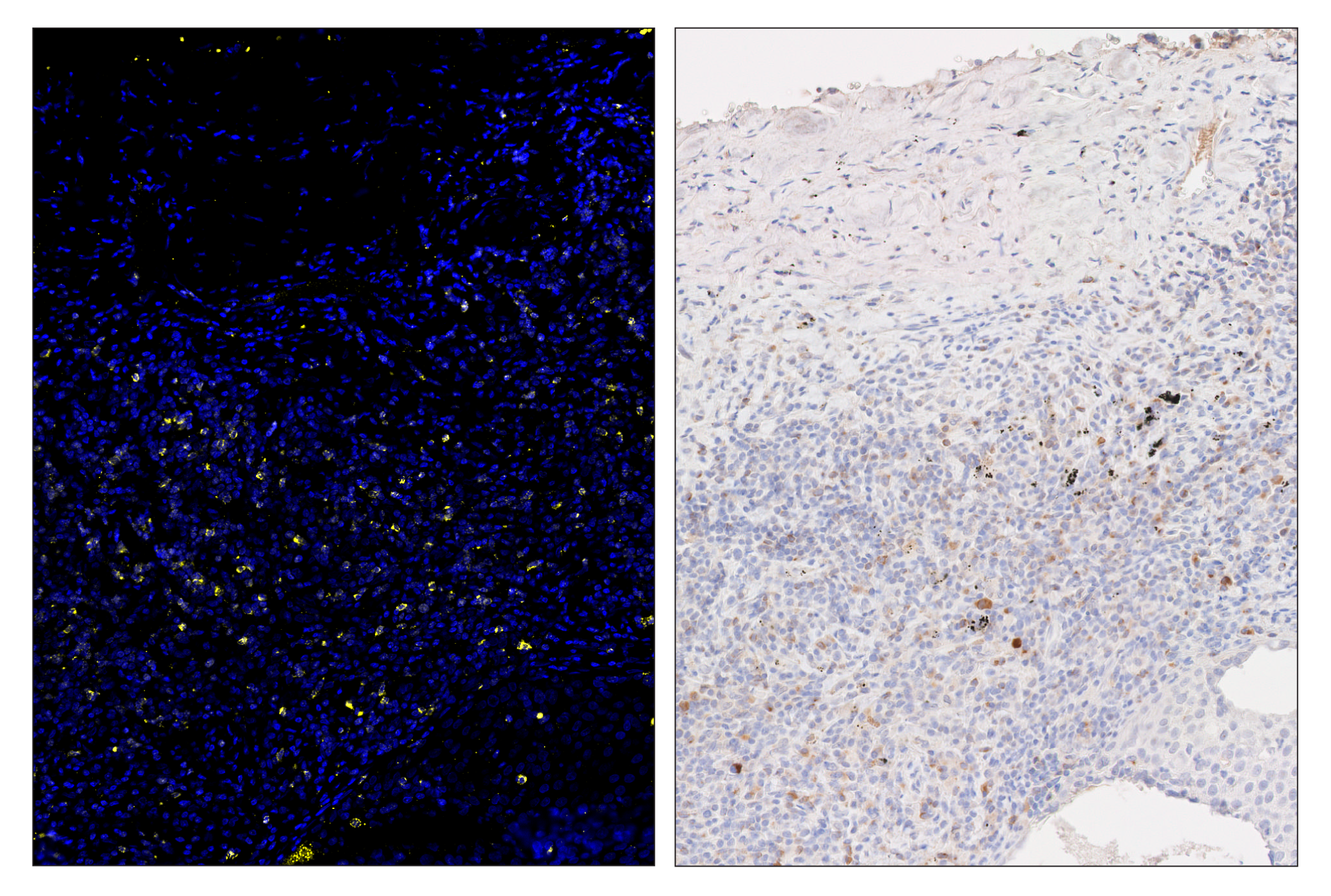Immunohistochemistry Image 5: CTLA-4 (E2V1Z) & CO-0078-594 SignalStar™ Oligo-Antibody Pair