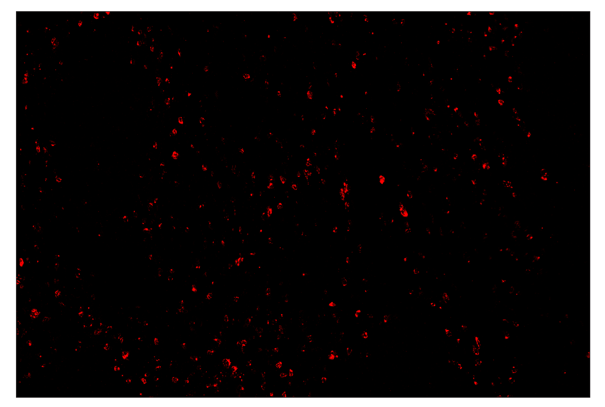 Immunohistochemistry Image 4: CTLA-4 (E2V1Z) & CO-0078-594 SignalStar™ Oligo-Antibody Pair