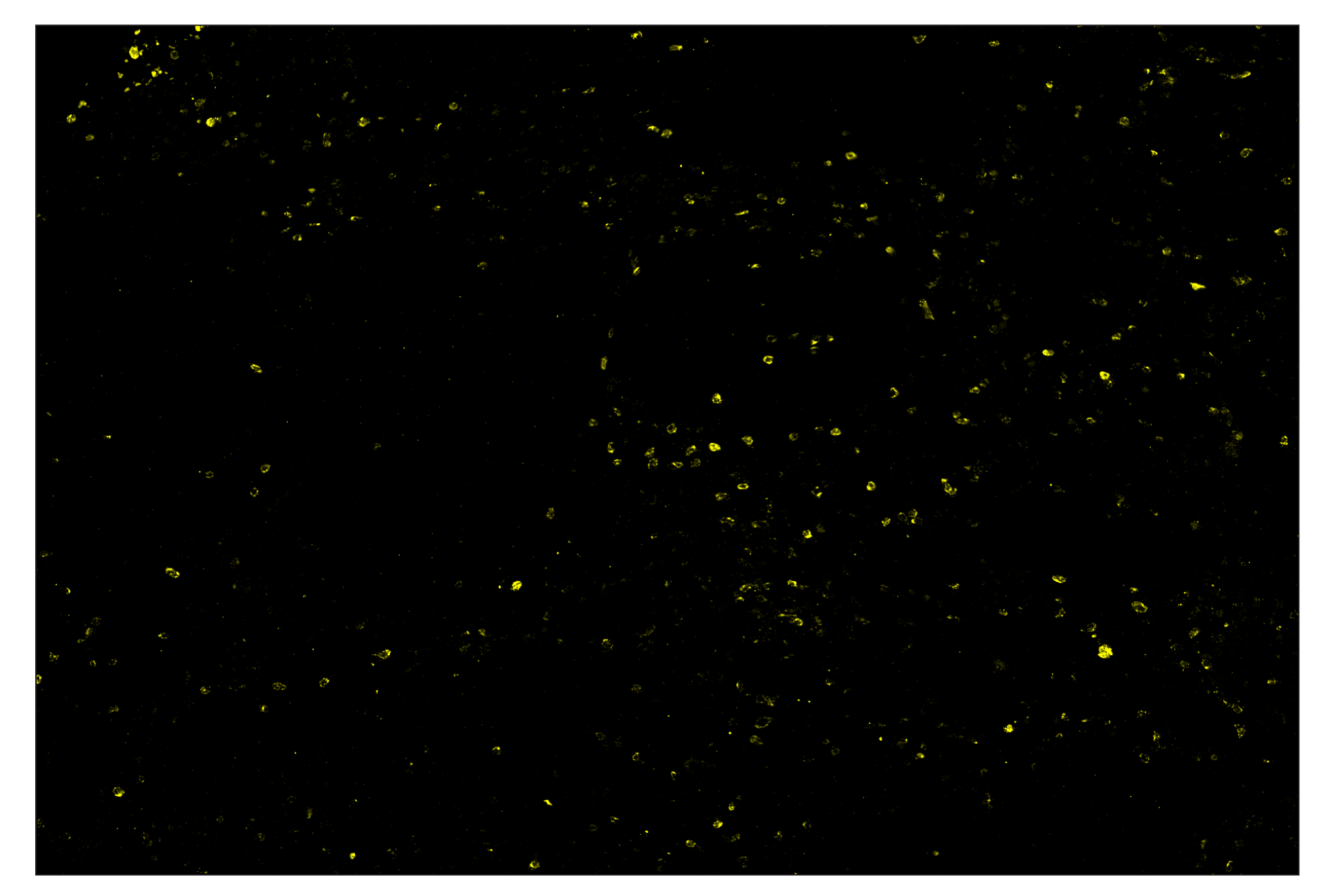 Immunohistochemistry Image 3: CTLA-4 (E2V1Z) & CO-0078-488 SignalStar™ Oligo-Antibody Pair