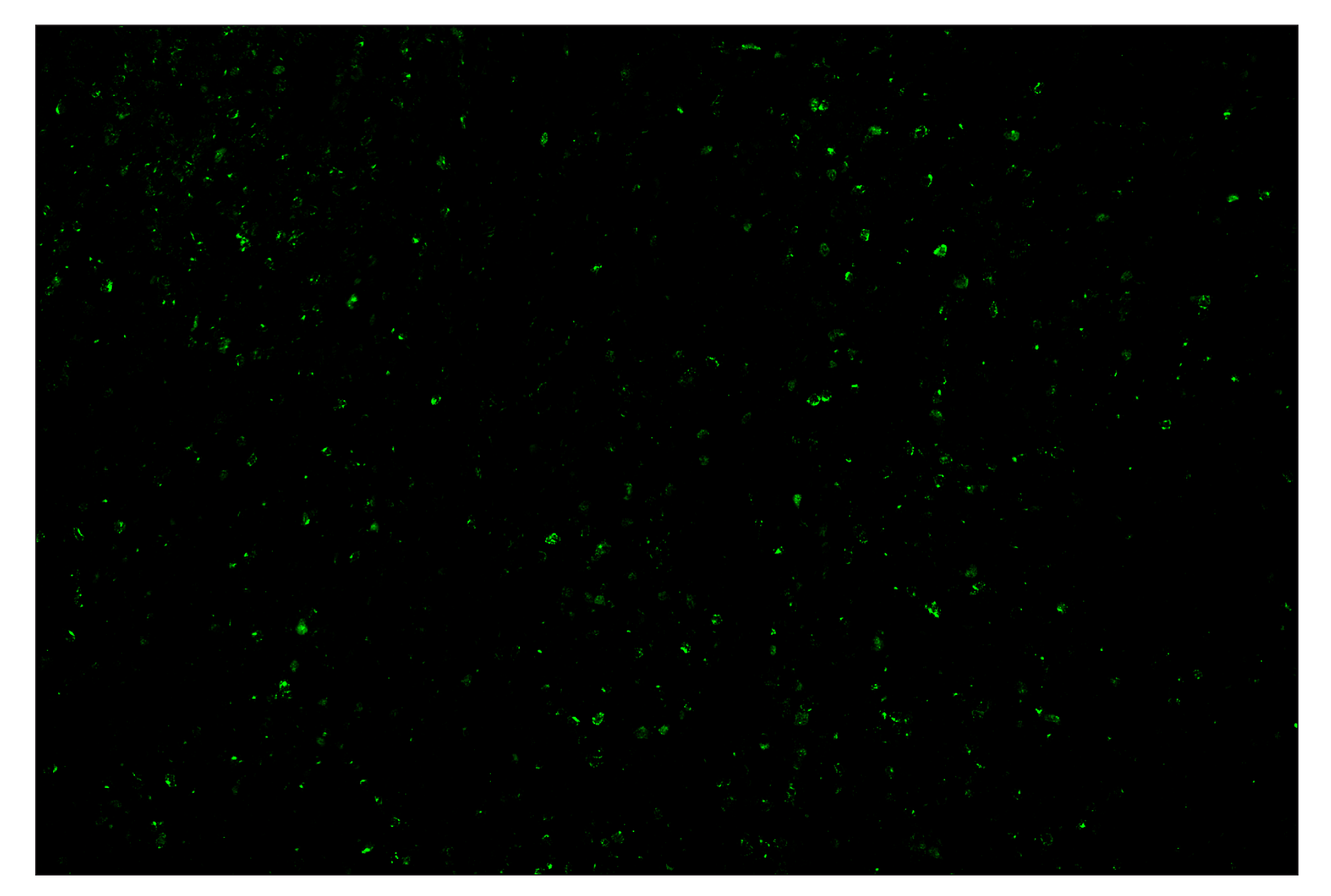 Immunohistochemistry Image 2: CTLA-4 (E2V1Z) & CO-0078-594 SignalStar™ Oligo-Antibody Pair