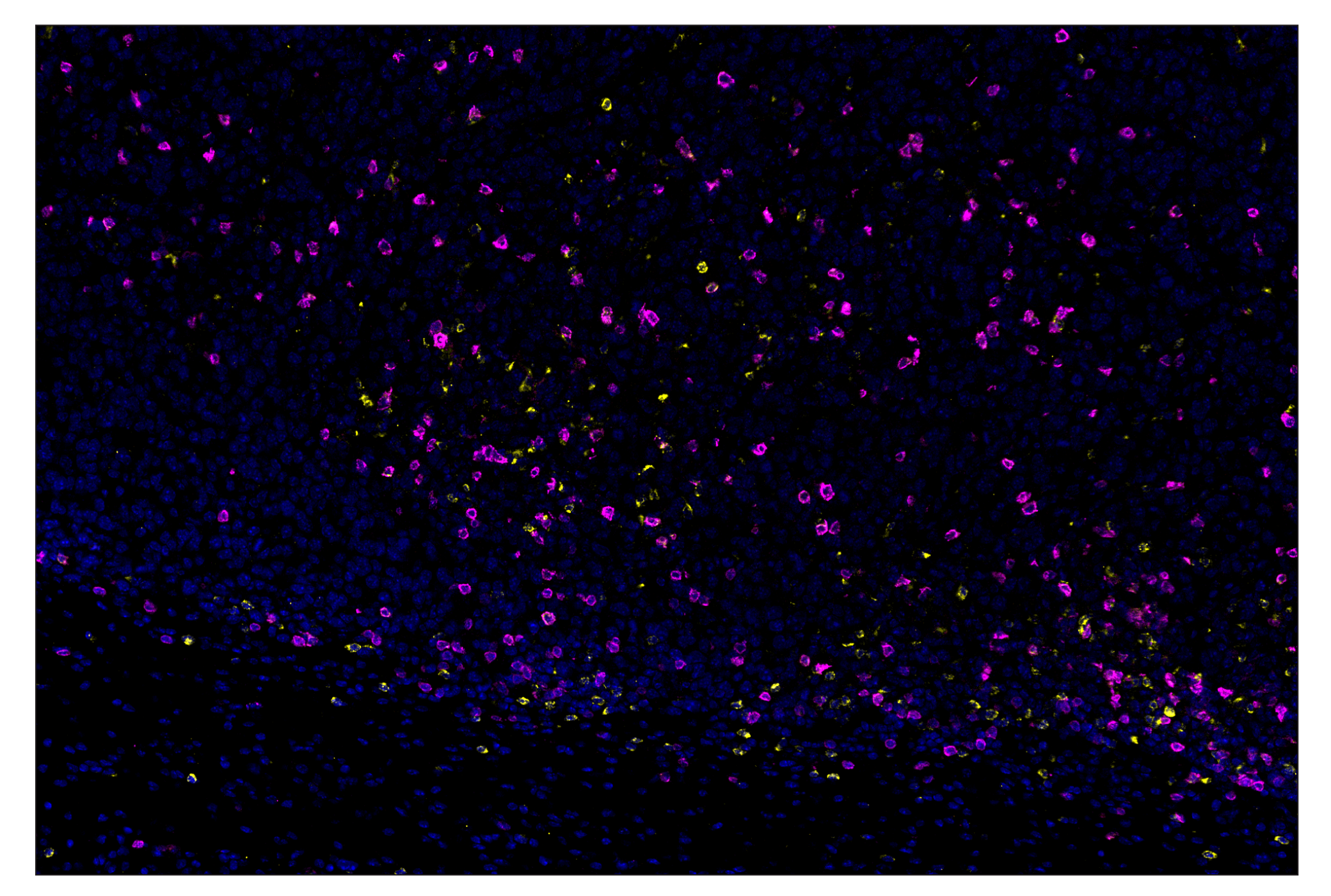 Immunohistochemistry Image 1: CTLA-4 (E2V1Z) & CO-0078-594 SignalStar™ Oligo-Antibody Pair
