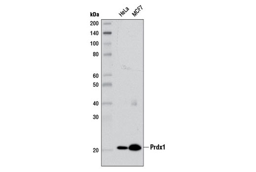  Image 9: Redox Homeostasis and Signaling Antibody Sampler Kit