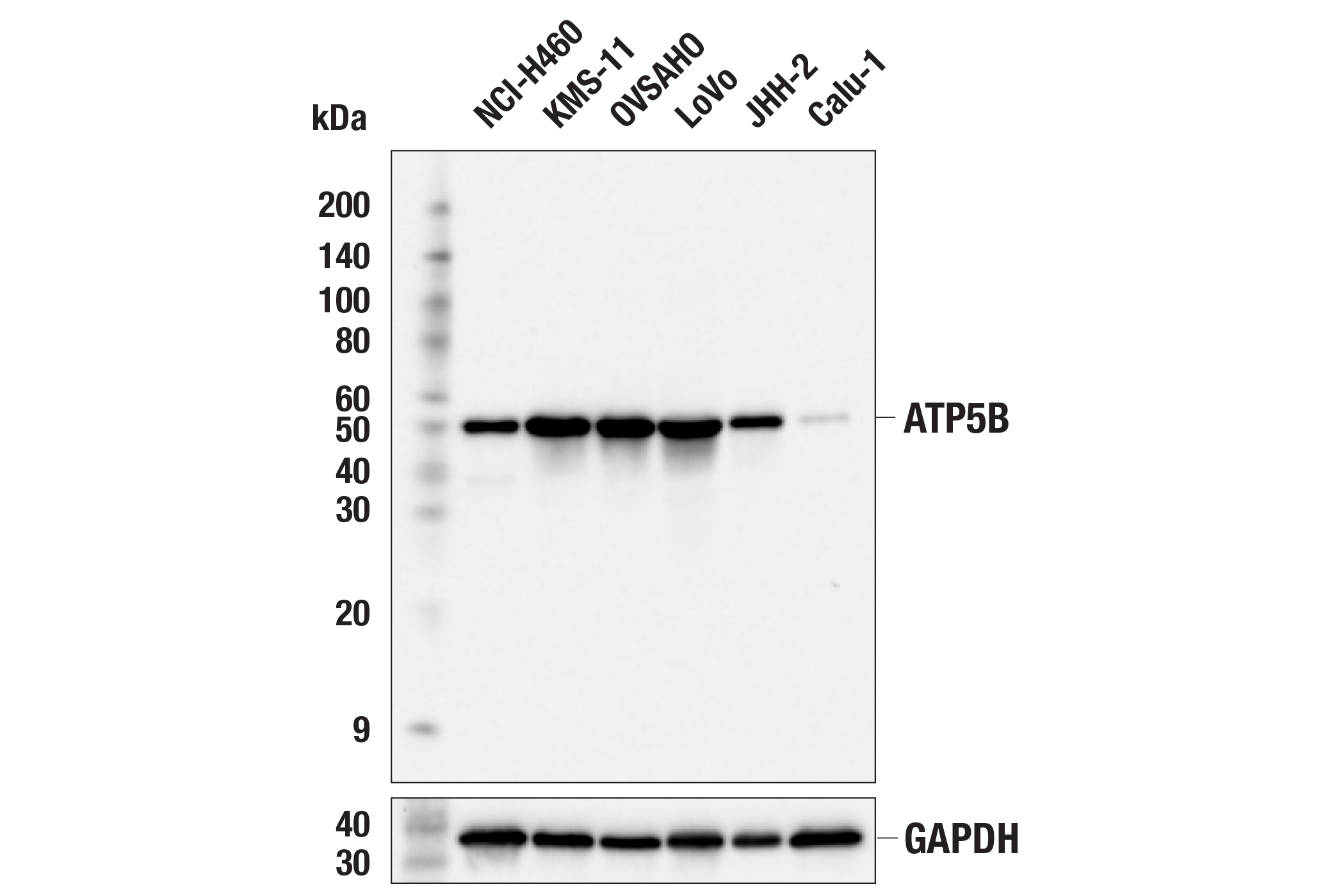 Western Blotting Image 1: ATP5B (E8A5A) Rabbit mAb