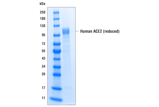  Image 1: Human ACE2 (multimeric) (18-652) Recombinant Protein