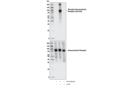 Western Blotting Image 1: Phospho-Glucocorticoid Receptor (Ser134) (E9R9W) Rabbit mAb