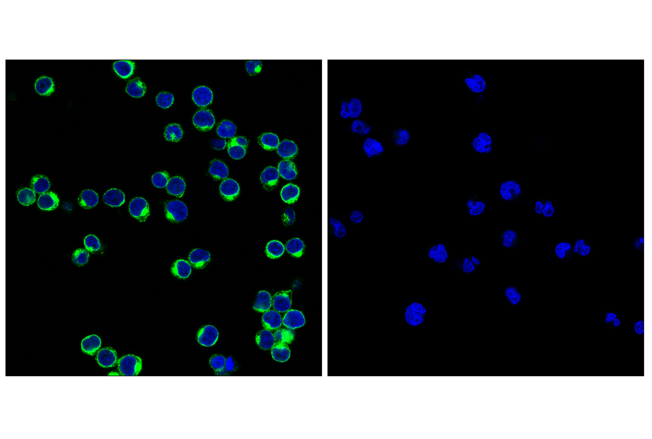  Image 4: Human Exhausted CD8+ T Cell IHC Antibody Sampler Kit