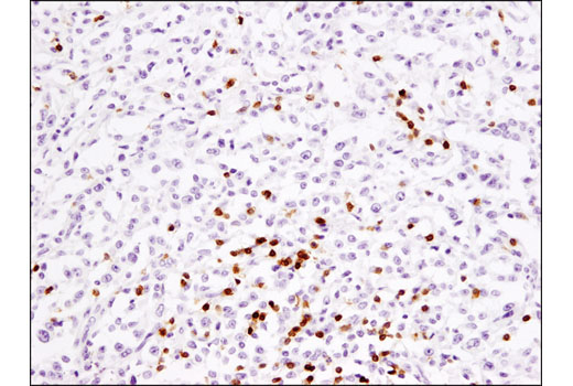  Image 52: Human Exhausted CD8+ T Cell IHC Antibody Sampler Kit