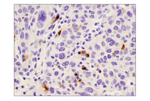 Immunohistochemistry Image 4: PD-L1 (D5V3B) Rabbit mAb (Mouse Specific; IHC Specific) (BSA and Azide Free)