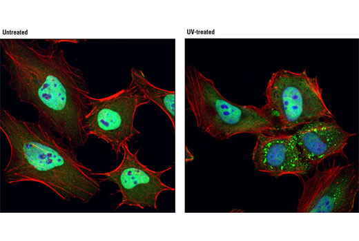 Immunofluorescence Image 1: TIAR (D32D3) XP® Rabbit mAb