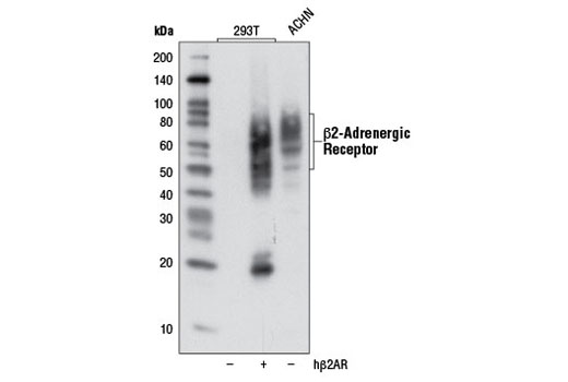 Western Blotting Image 1: β2-Adrenergic Receptor (D6H2) Rabbit mAb
