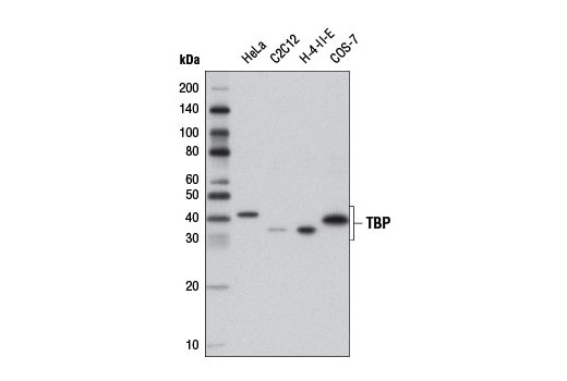 Western Blotting Image 1: TBP Antibody