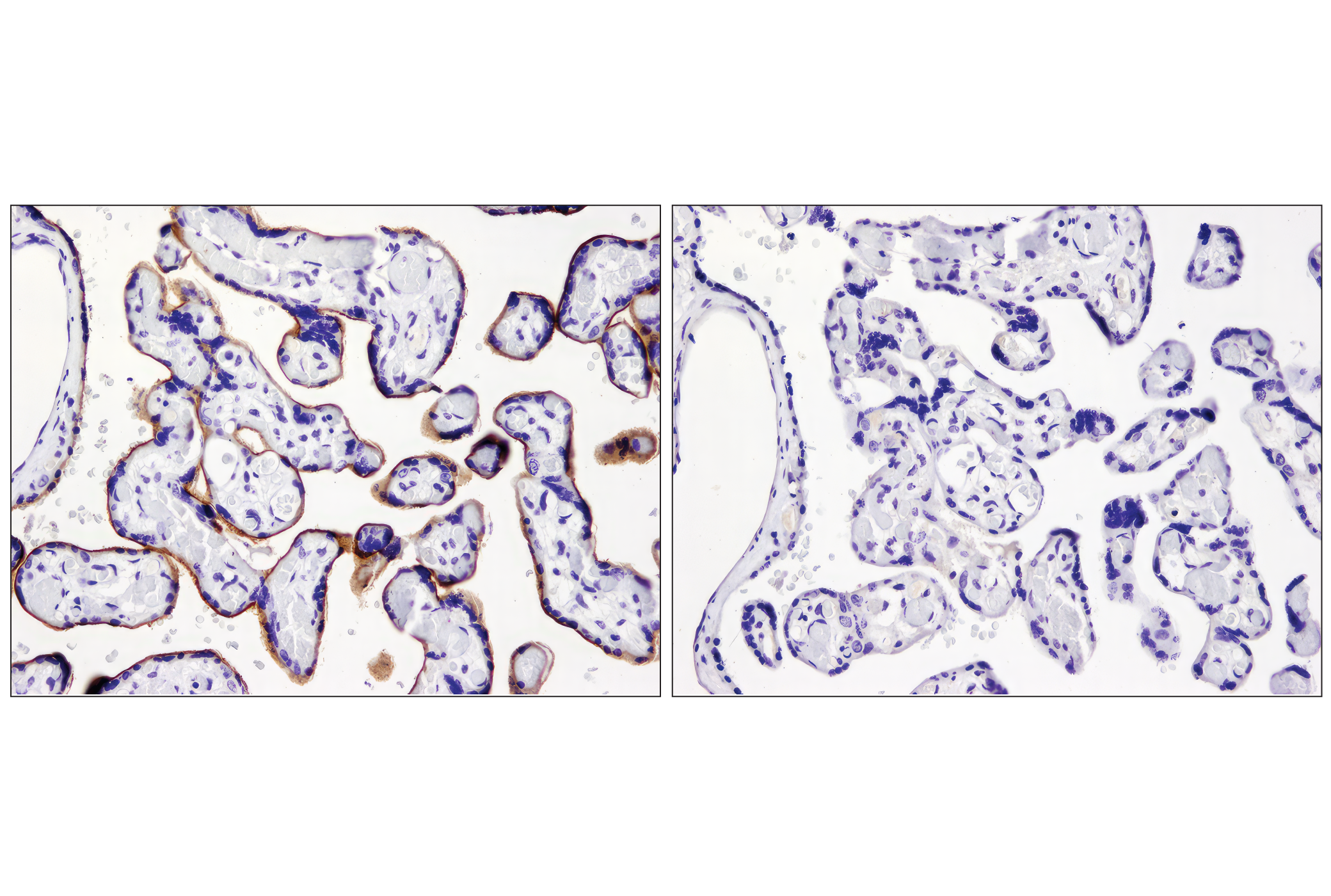 Immunohistochemistry Image 3: PD-L1 (E1L3N®) XP® Rabbit mAb (BSA and Azide Free)