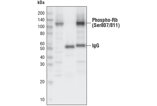 Immunoprecipitation Image 1: Phospho-Rb (Ser807/811) (D20B12) XP® Rabbit mAb