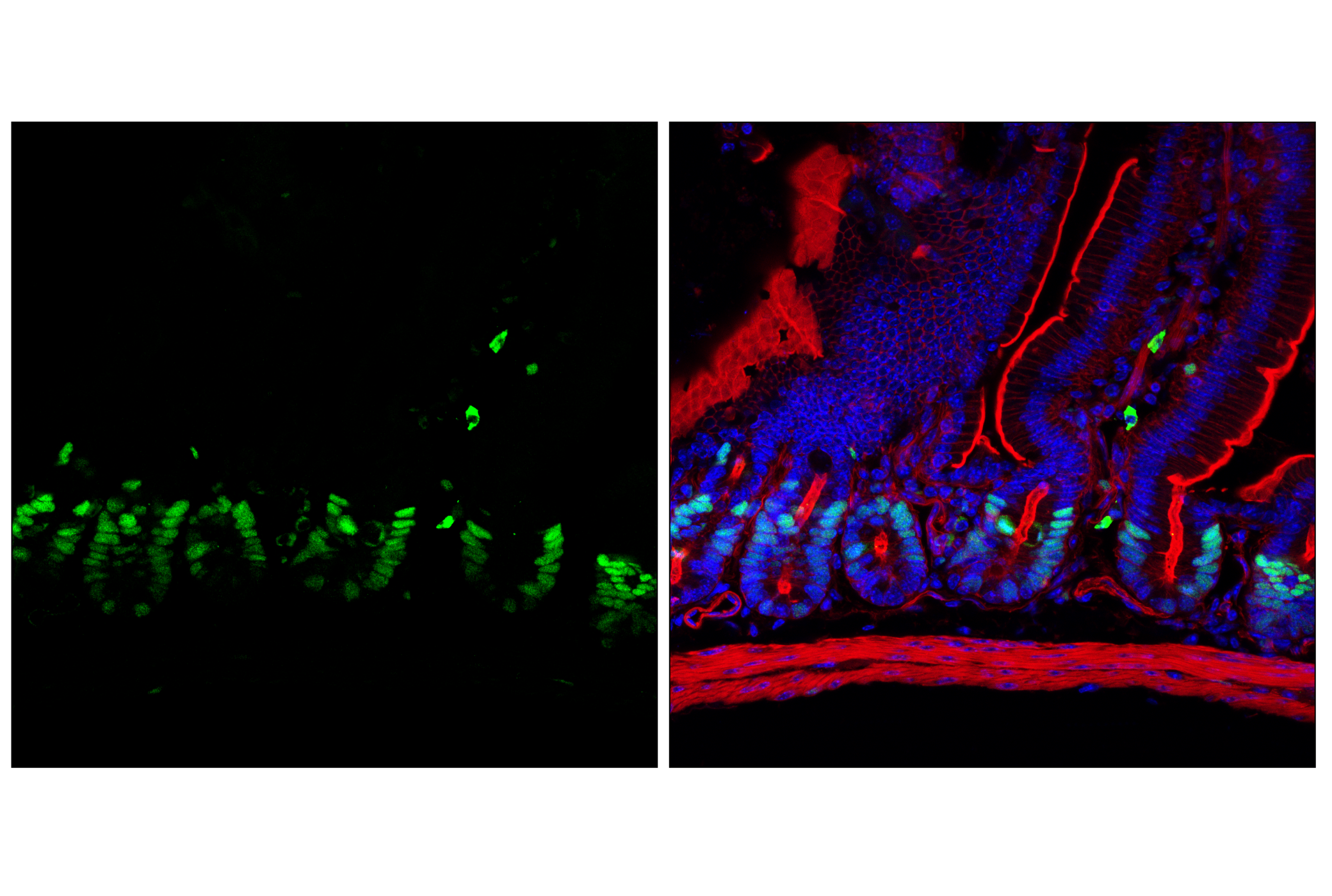 Immunofluorescence Image 1: Phospho-Rb (Ser807/811) (D20B12) XP® Rabbit mAb