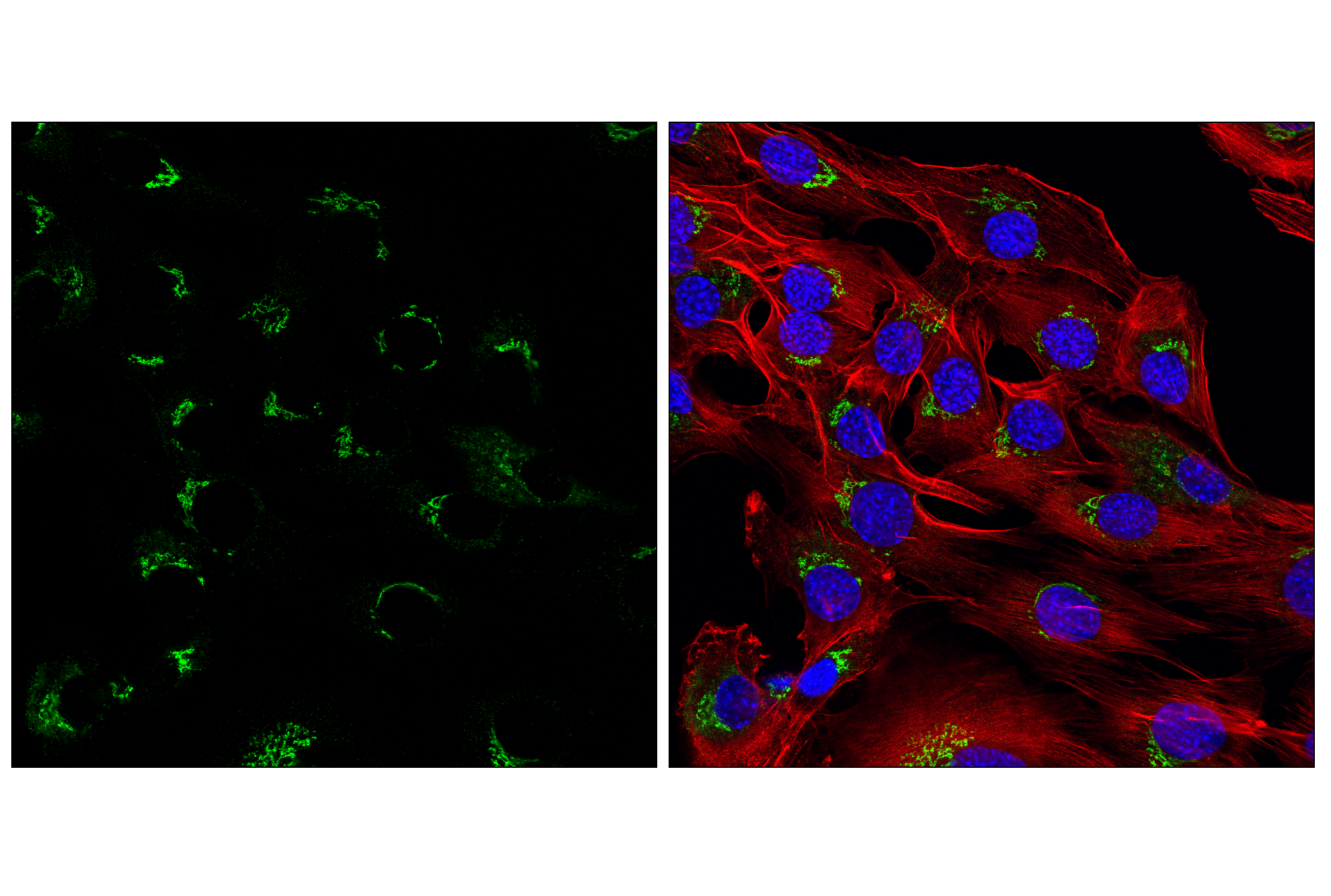 Immunofluorescence Image 2: TGOLN2/TGN38 (E6B6A) Rabbit mAb