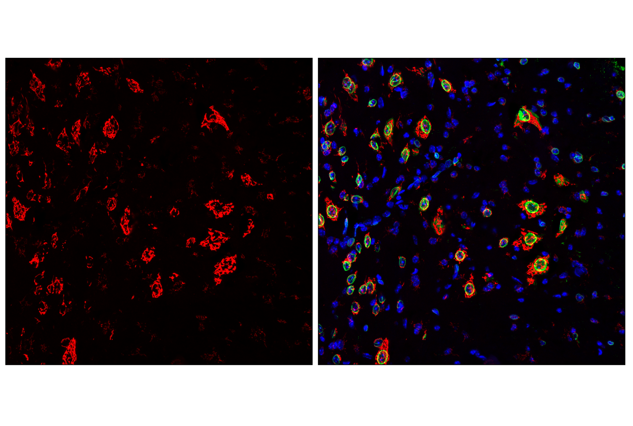 Immunofluorescence Image 1: TGOLN2/TGN38 (E6B6A) Rabbit mAb