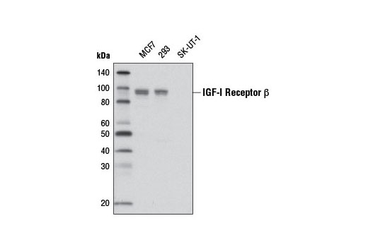 Western Blotting Image 1: IGF-I Receptor β (D23H3) XP® Rabbit mAb (Biotinylated)