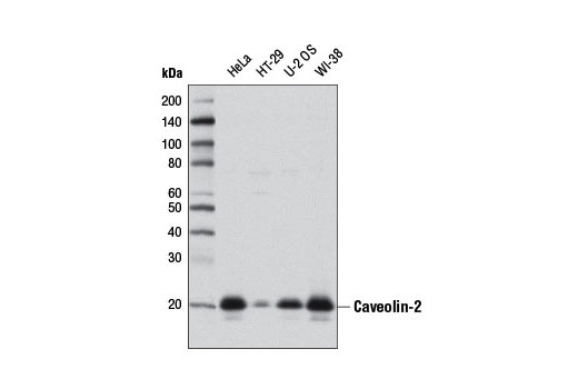 Western Blotting Image 1: Caveolin-2 (D4A6) XP® Rabbit mAb