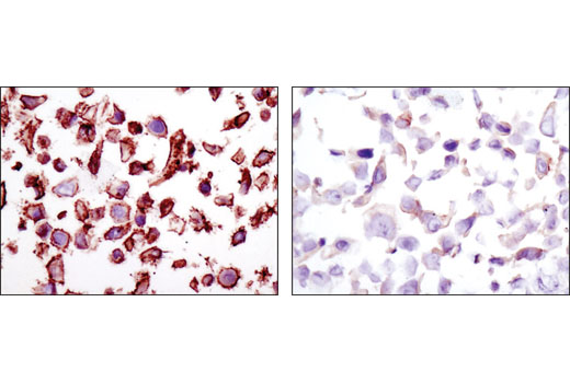 Immunohistochemistry Image 5: HER2/ErbB2 (D8F12) XP® Rabbit mAb (BSA and Azide Free)