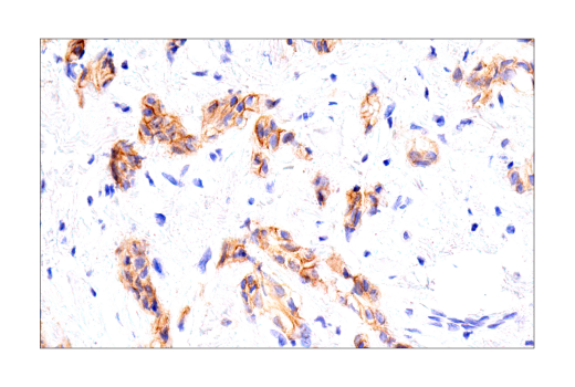 Immunohistochemistry Image 7: HER2/ErbB2 (D8F12) XP® Rabbit mAb (BSA and Azide Free)