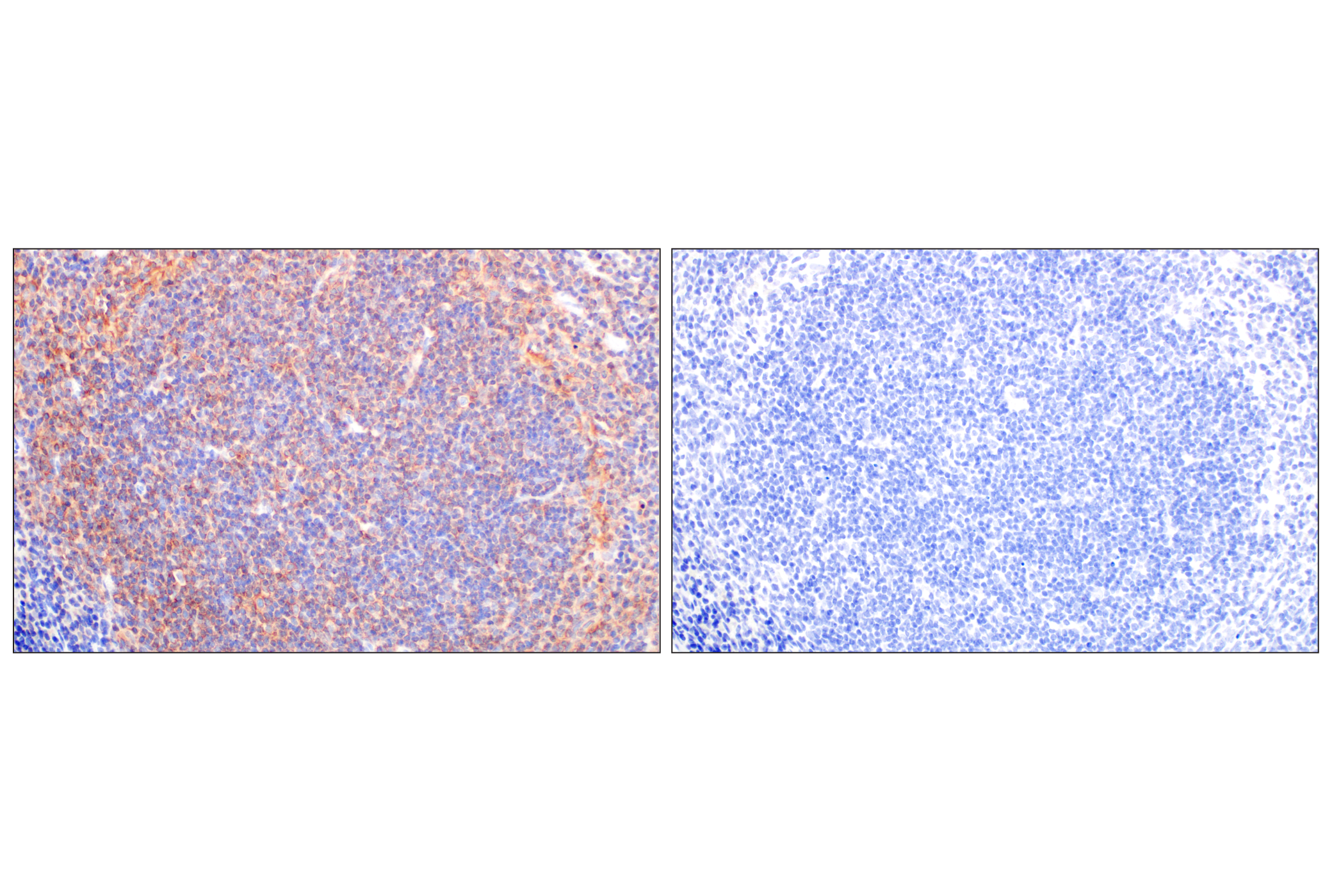 Immunohistochemistry Image 7: CCL3/MIP-1α (F2M8Q) Rabbit mAb