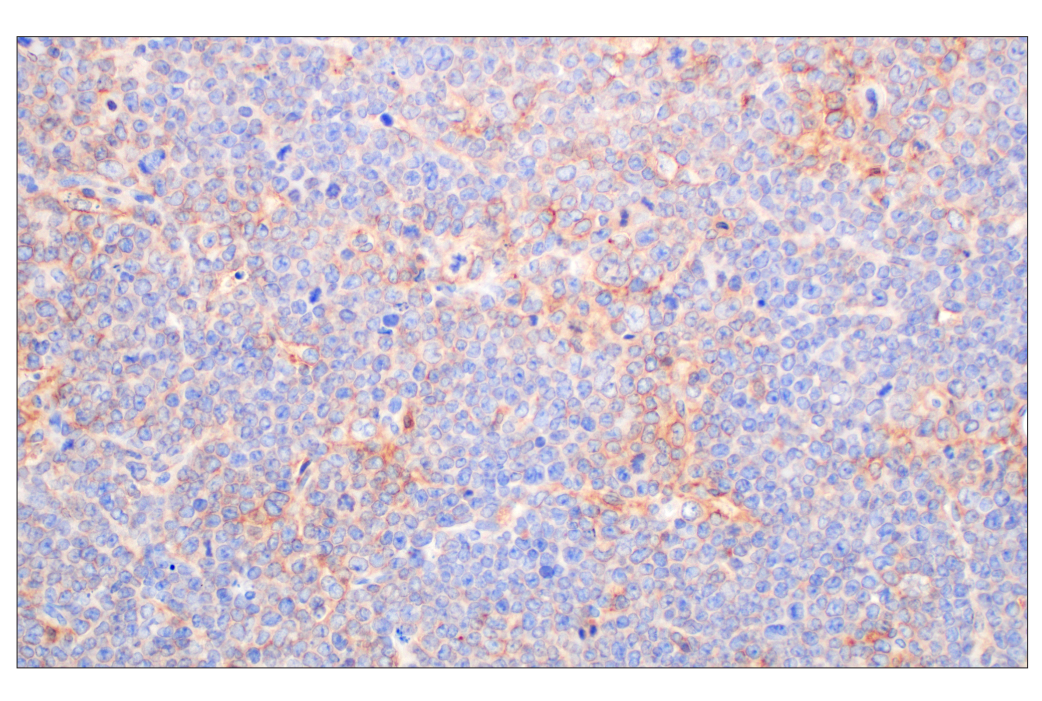 Immunohistochemistry Image 1: CCL3/MIP-1α (F2M8Q) Rabbit mAb