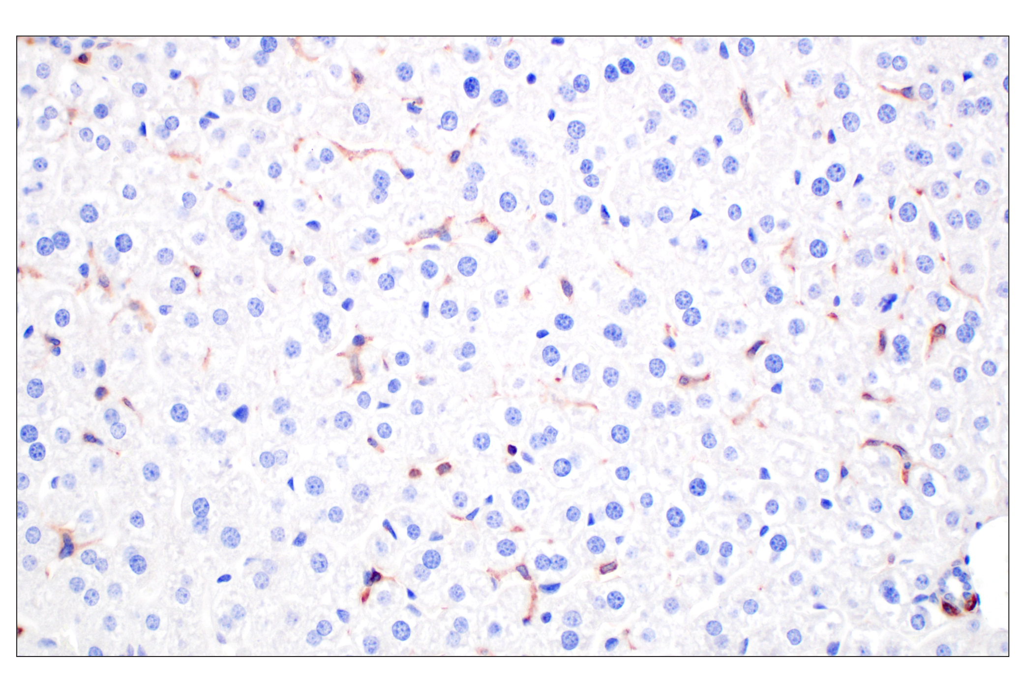 Immunohistochemistry Image 6: CCL3/MIP-1α (F2M8Q) Rabbit mAb