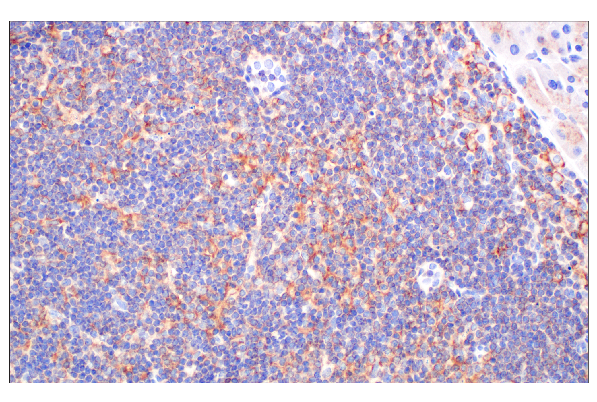 Immunohistochemistry Image 4: CCL3/MIP-1α (F2M8Q) Rabbit mAb