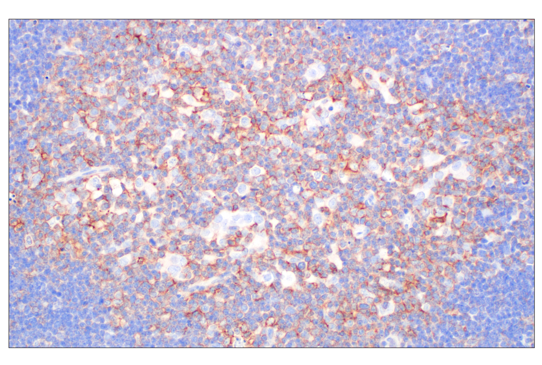 Immunohistochemistry Image 3: CCL3/MIP-1α (F2M8Q) Rabbit mAb