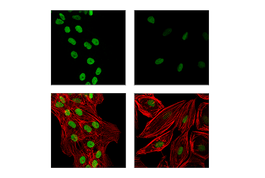 Immunofluorescence Image 1: EED (E4L6E) XP® Rabbit mAb