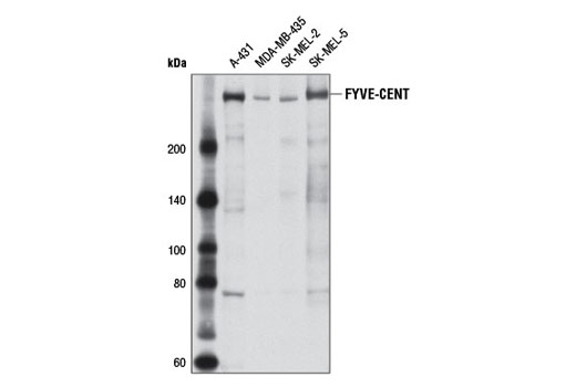 Western Blotting Image 1: FYVE-CENT Antibody