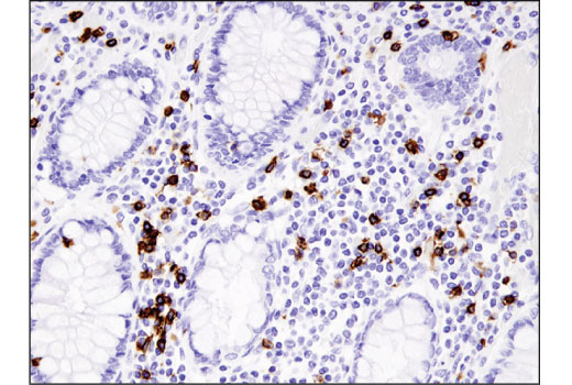  Image 22: Human Exhausted CD8+ T Cell IHC Antibody Sampler Kit