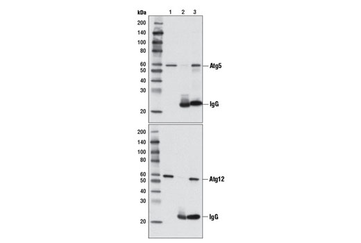 Immunoprecipitation Image 1: Atg5 (D1G9) Rabbit mAb